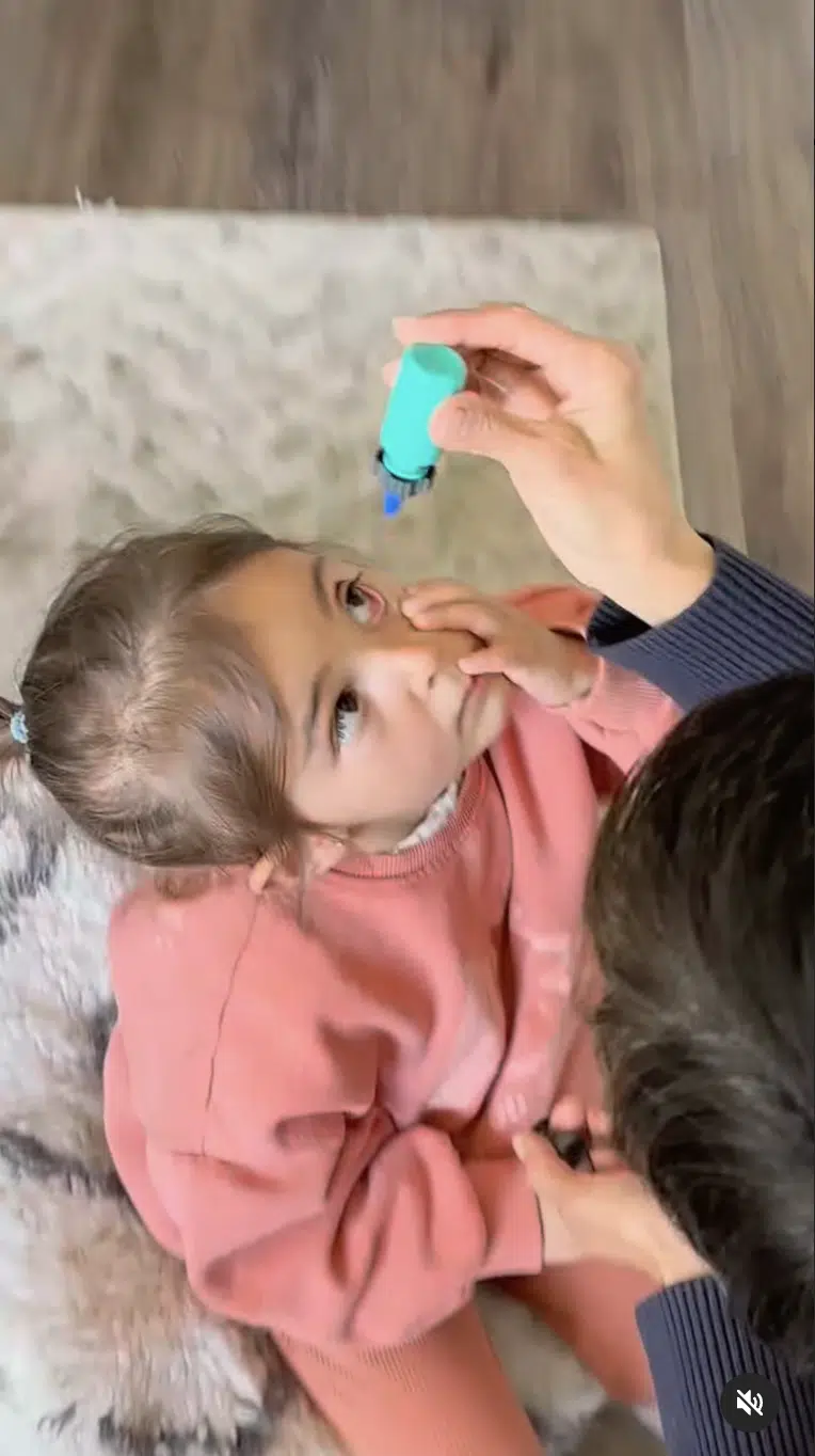 Parent gently applying eye drops to a young child using the Nanodropper adaptor."
